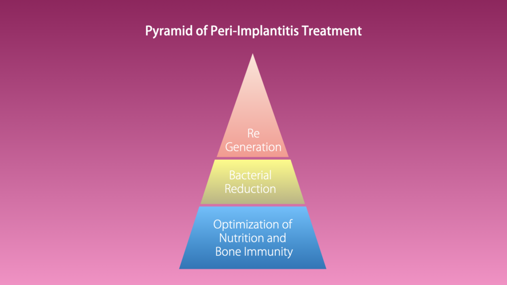 インプラント周囲炎治療ピラミッド 免疫と栄養・除菌・再生